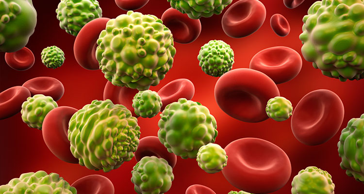 Un estudio de la UC3M describe matemáticamente cómo crecen los tumores