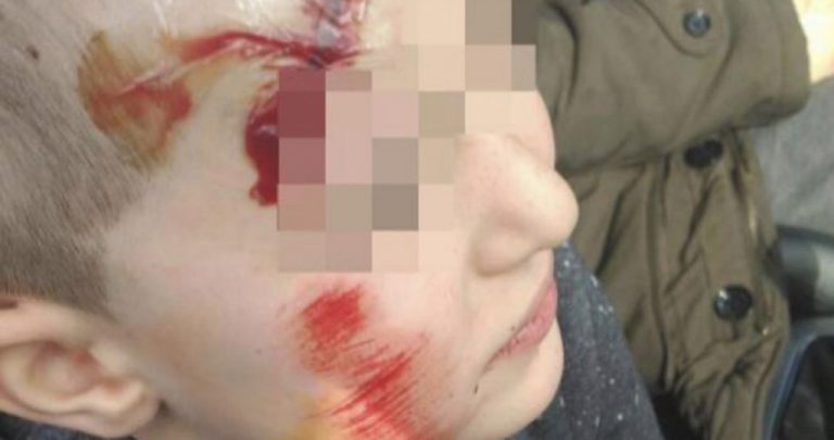 Denuncian una agresión por bullying a un niño de 6 años en Leganés