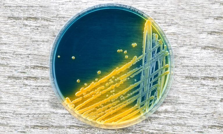 Un modelo anticipa el comportamiento de la principal bacteria causante de gastroenteritis