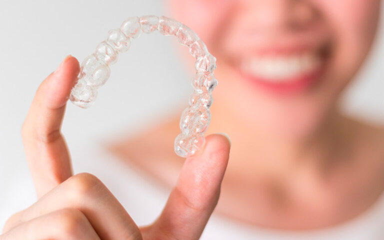 Invisalign: ¿cómo funciona?