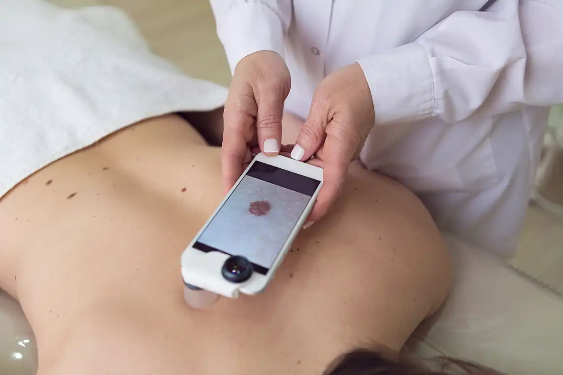 aplicacion dermatologos oms